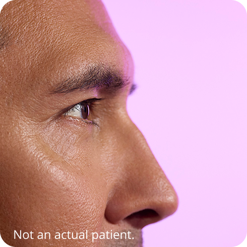 Close-up side profile of a man's face, focused on the eye, against a pink background. Caption reads “Not an actual patient.”